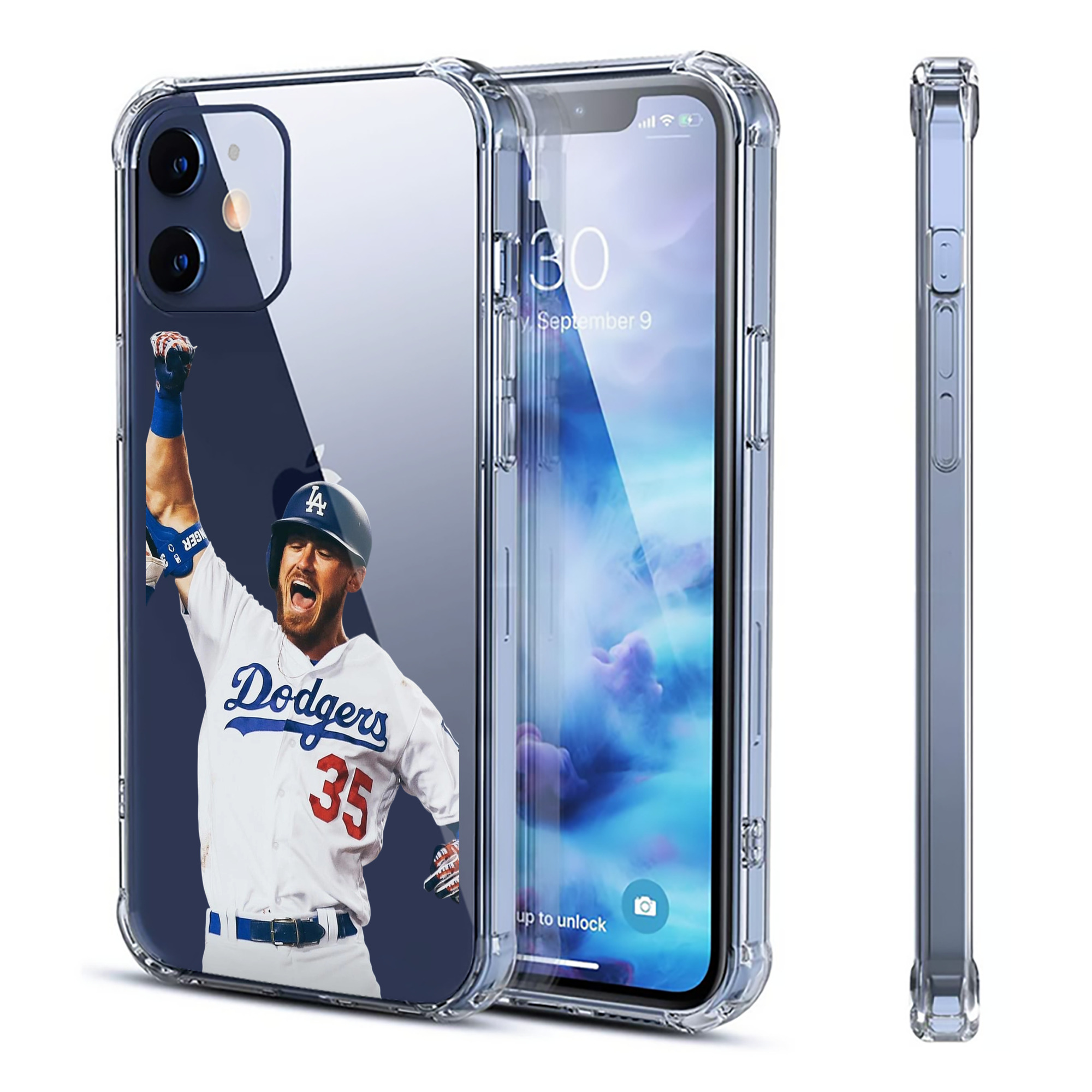  Clear IPhone 12 Case – Soft TPU With UV Print – Enhanced Drop Protection, Precise Fit, Anti-Fingerprint, Customizable Design, Scratch-Resistant, Yellow-Resistant